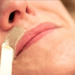 Facial Hair Removal