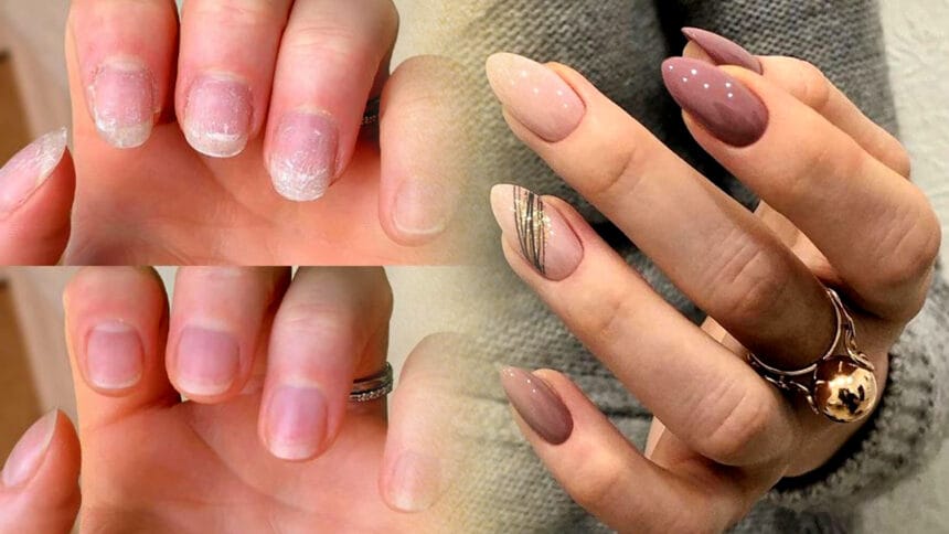 Nail Care Tips