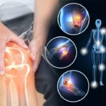 Arthritis Pain Relief