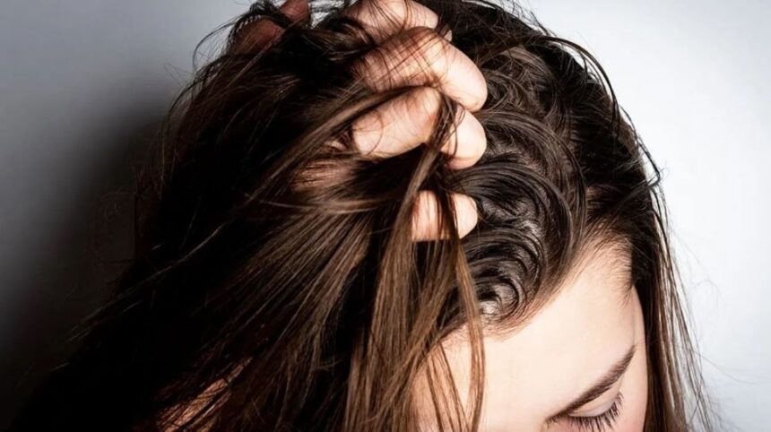 Oily Scalp Tips