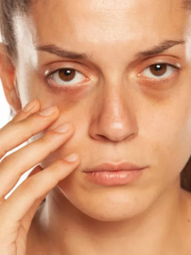 চোখের তলায় কালি দূর করুন ঘরোয়া উপায়ে