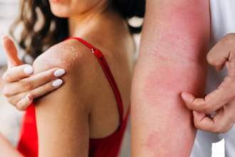 Summer Skin Care Tips