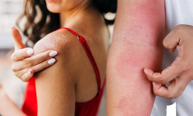 Summer Skin Care Tips