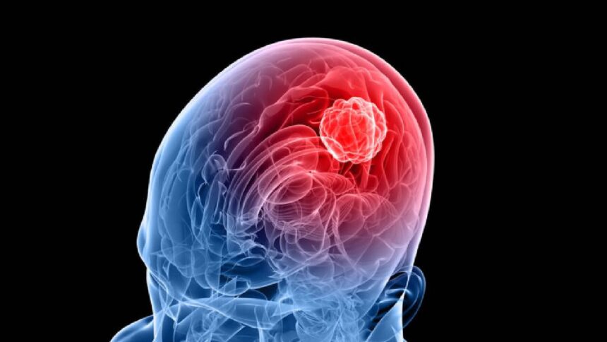 Child Brain Tumor