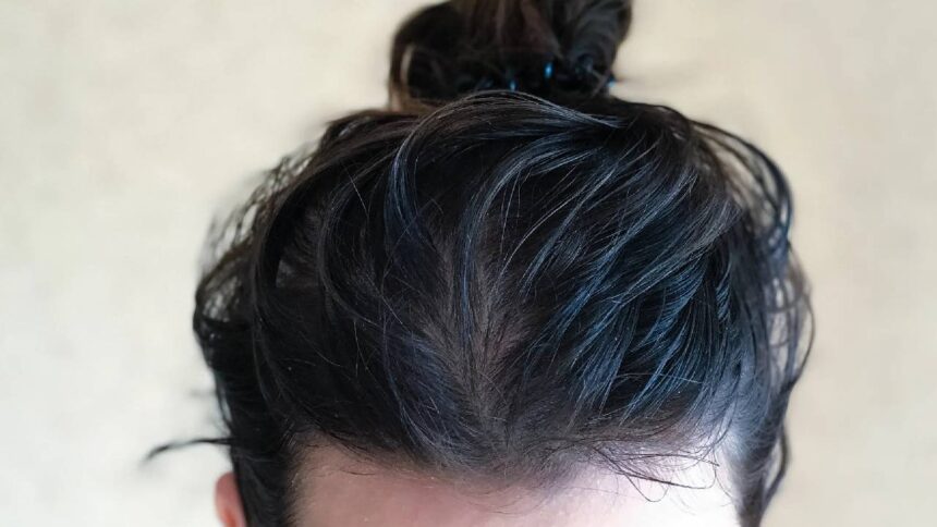 Oily Hair