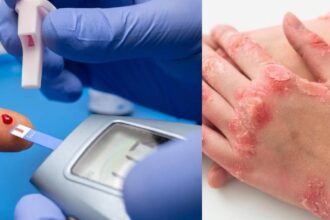 Diabetes Skin Problems