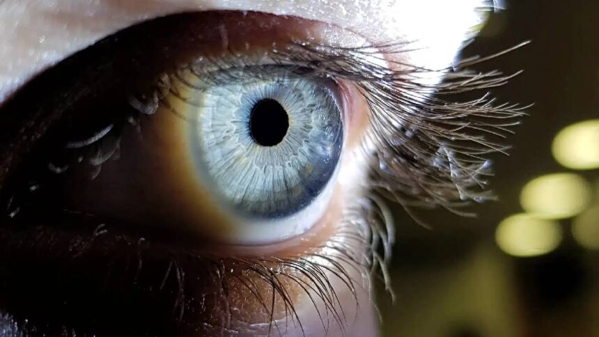 Eye Floaters