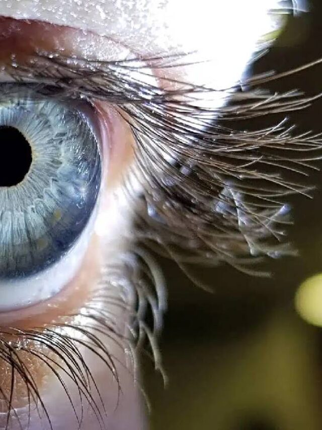 চোখে কালো বিন্দু দেখলে অবহেলা নয়, কী বলছেন বিশেষজ্ঞরা…