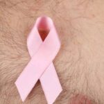 Male Breast Cancer