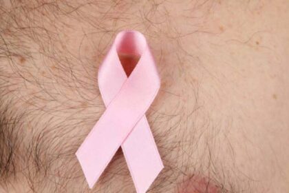 Male Breast Cancer