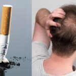 Smoke and Hair Loss