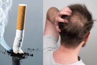 Smoke and Hair Loss