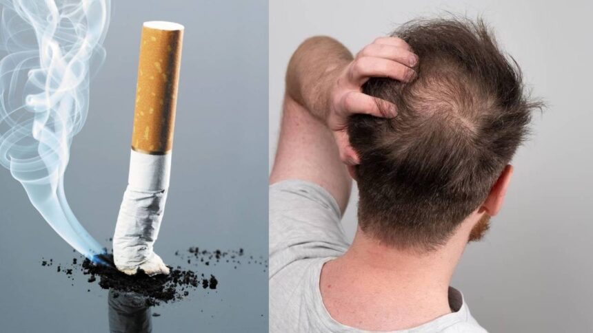 Smoke and Hair Loss
