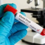 Ebola Virus