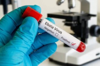 Ebola Virus