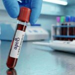 Cholesterol Test