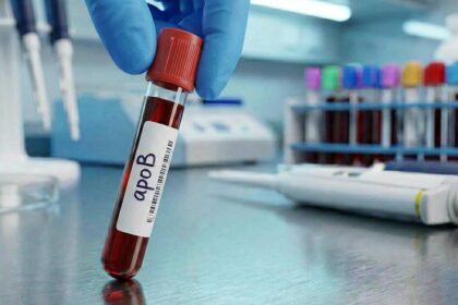 Cholesterol Test