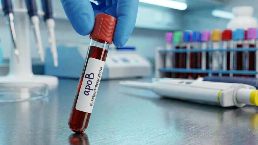 Cholesterol Test