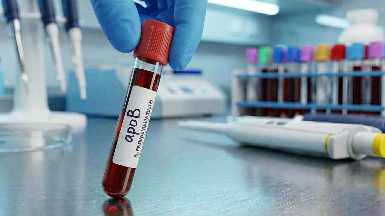 Cholesterol Test