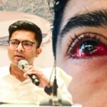 Abhishek Eye Treatment