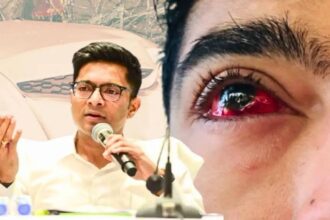 Abhishek Eye Treatment