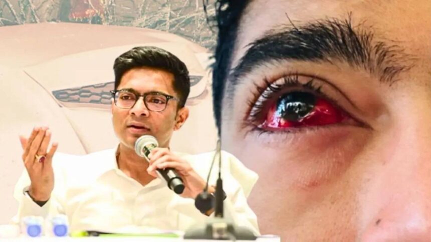 Abhishek Eye Treatment